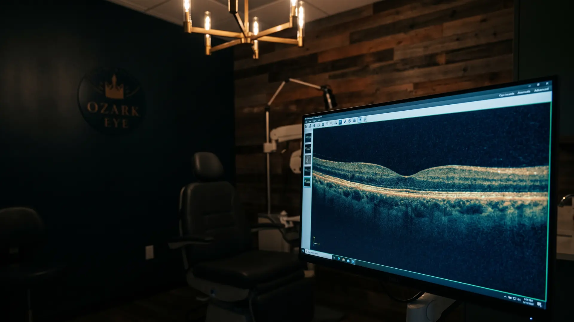 Eye disease management and treatment at Ozark Eye in Pea Ridge, Arkansas