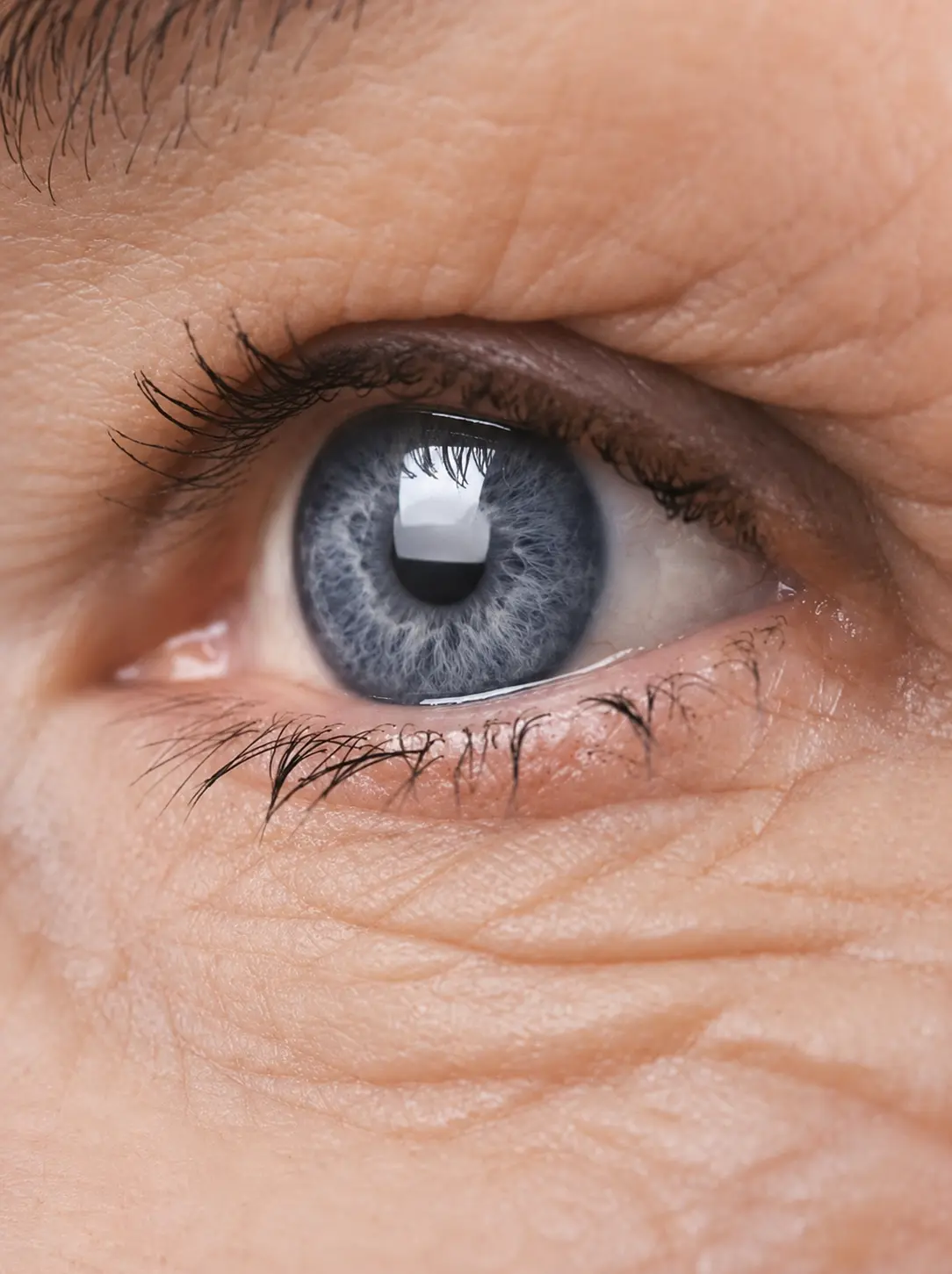 Cataract Co-Management at Ozark Eye in Pea Ridge